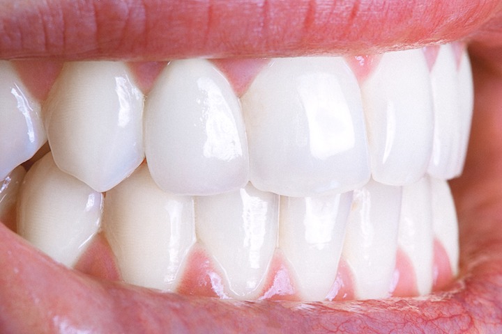 Tips to Help Keep Your Teeth White - Dynamic Smile Design