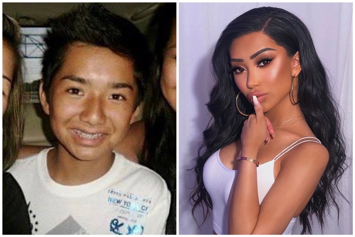 Nikita Dragun S Plastic Surgery Journey Before And Af 9213