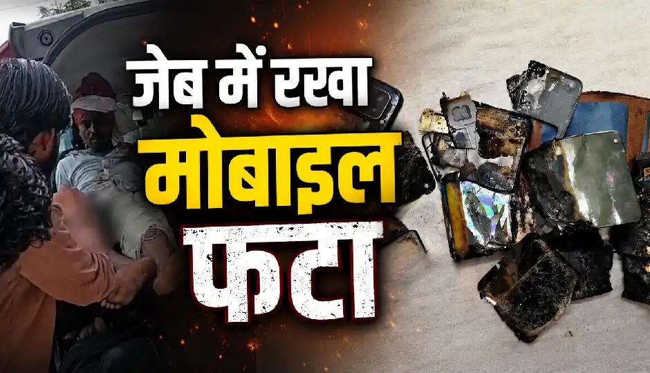 जेब में रखा मोबाइल अचानक फटा, प्राइवेट पार्ट समेत शरीर के कई हिस्से झुलसे; पैर की हड्डी भी टूटी