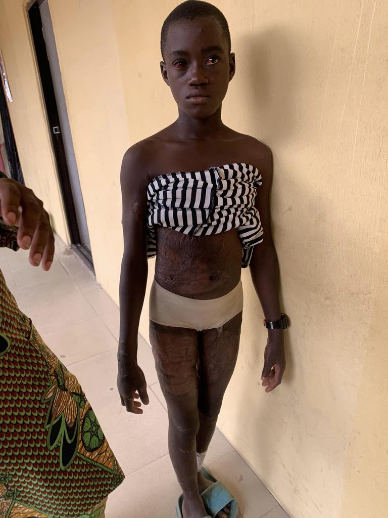 Woman subjects her 12-year-old stepdaughter to h0rrific ab*se with kn!fe, cutlass and fire for eating food without her permission (video)