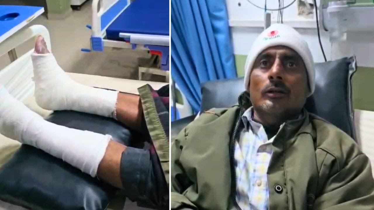 कबूलनामे के लिए थाने में युवक को मार-मारकर तोड़ डाले 5 डंडे, UP पुलिस की पिटाई से टूट गए दोनों पैर; ACP हटाए गए, 3 सस्पेंड