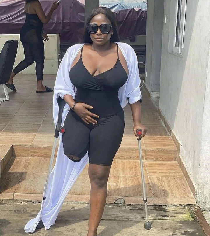 See photo of the beautiful amputee lady trending online