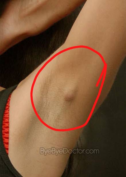 If You Start Noticing These 3 Signs You Might Be Hiv Aids Positive Go For A Test Sleek Gist