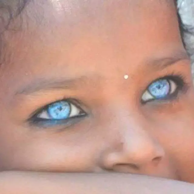 Wonderful! Photos Little Kids That Were Born With Strange Eyes