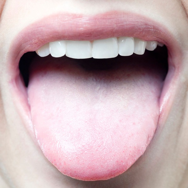 Health warning signs you may spot on your tongue from infection to cancer - Daily Record