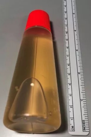 The 73-year-old had placed a plastic container of liquid glue with an attached thread into his bottom