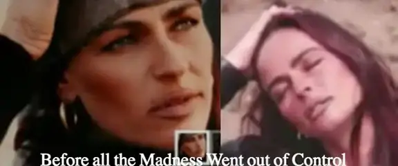 SURGERY GONE WRONG: Much Surgery Turned This Lady Look (See Photos)