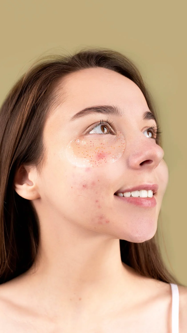 Pimple patch