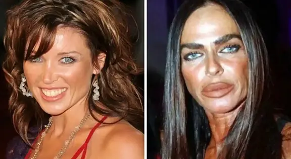 SURGERY GONE WRONG: Much Surgery Turned This Lady Look (See Photos)