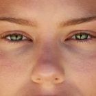 Got Green Eyes? This Doctor Has News For You