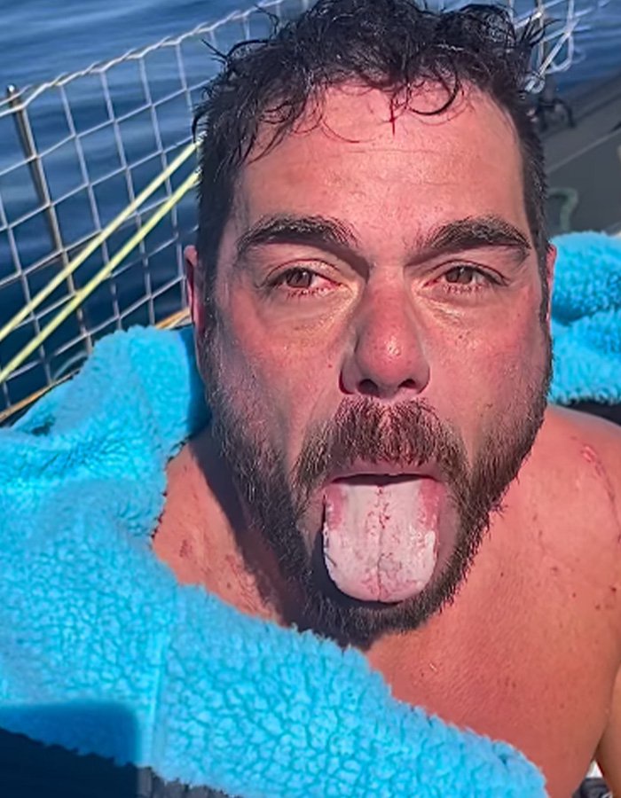Extreme swimmer sticks out his tongue showing severe irritation and white coating after a long open water swim