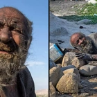 Tragic reason why ‘world’s dirtiest man’ didn’t wash for 60 years before his death