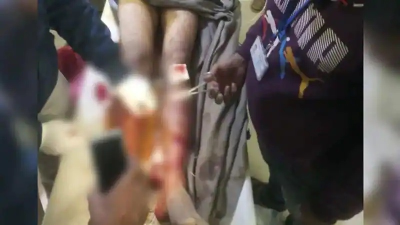 Rajasthan Barmer RTI activist kidnapped and thrashed mercilessly by miscreants and left on road in immaterial condition UDT