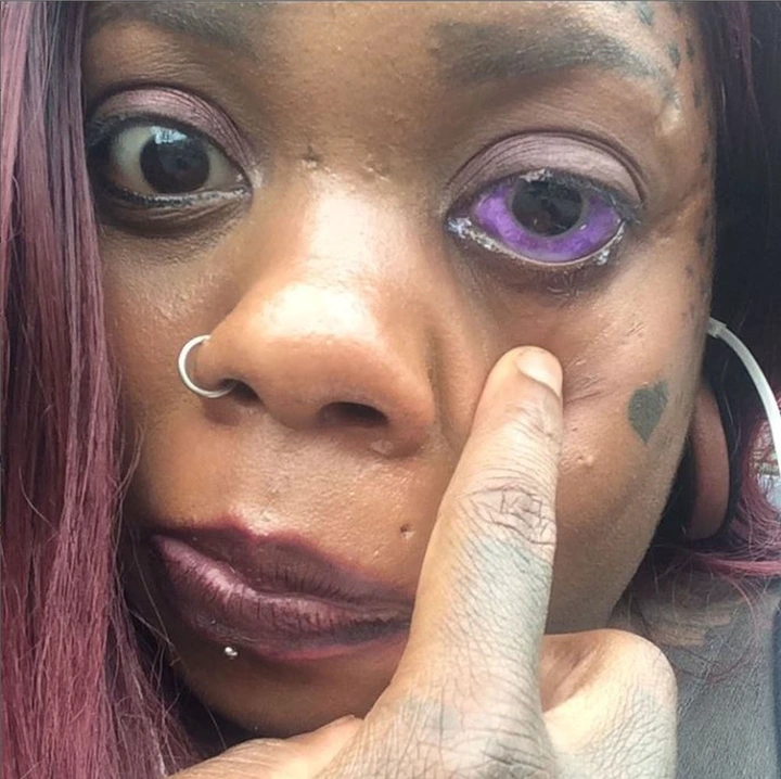 peterson's purple eye