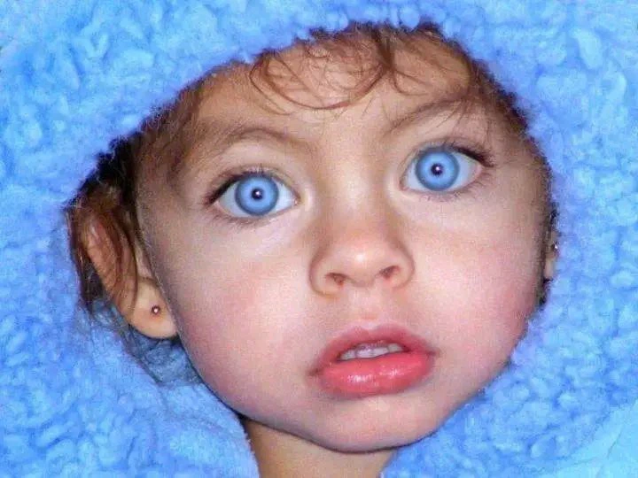 Wonderful, Photos Kids That Where Born With Strange Eyes (Opinion)