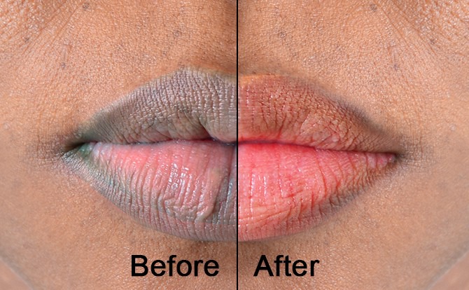 5 naturally ways to make your lips soft and pink | Pulse Nigeria