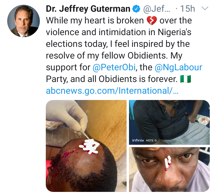Lagos Election: Guterman Sends Message To LP & Obi After Seeing Some 'Obidients' Injured