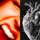 Science shows how a surge of anger could raise heart attack risk
