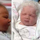 Baby Is Born With Head Full Of Gray Hair, Doctors Finally Realize Why