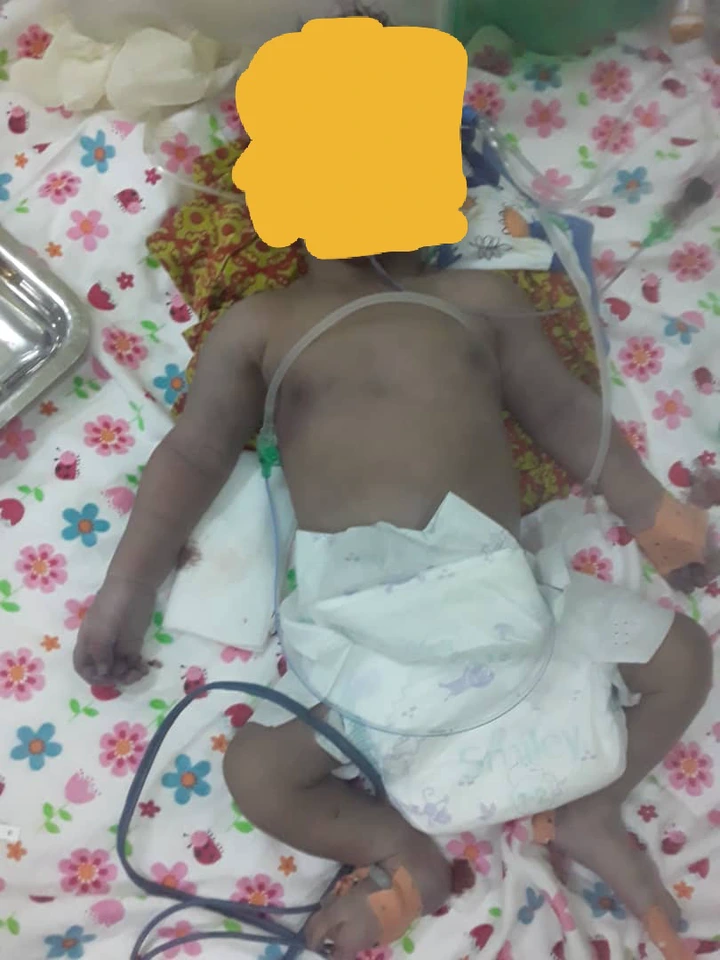 Abobo Une Nouveau Nee Laissee Pour Mort Par Des Sages Femmes Necrologie