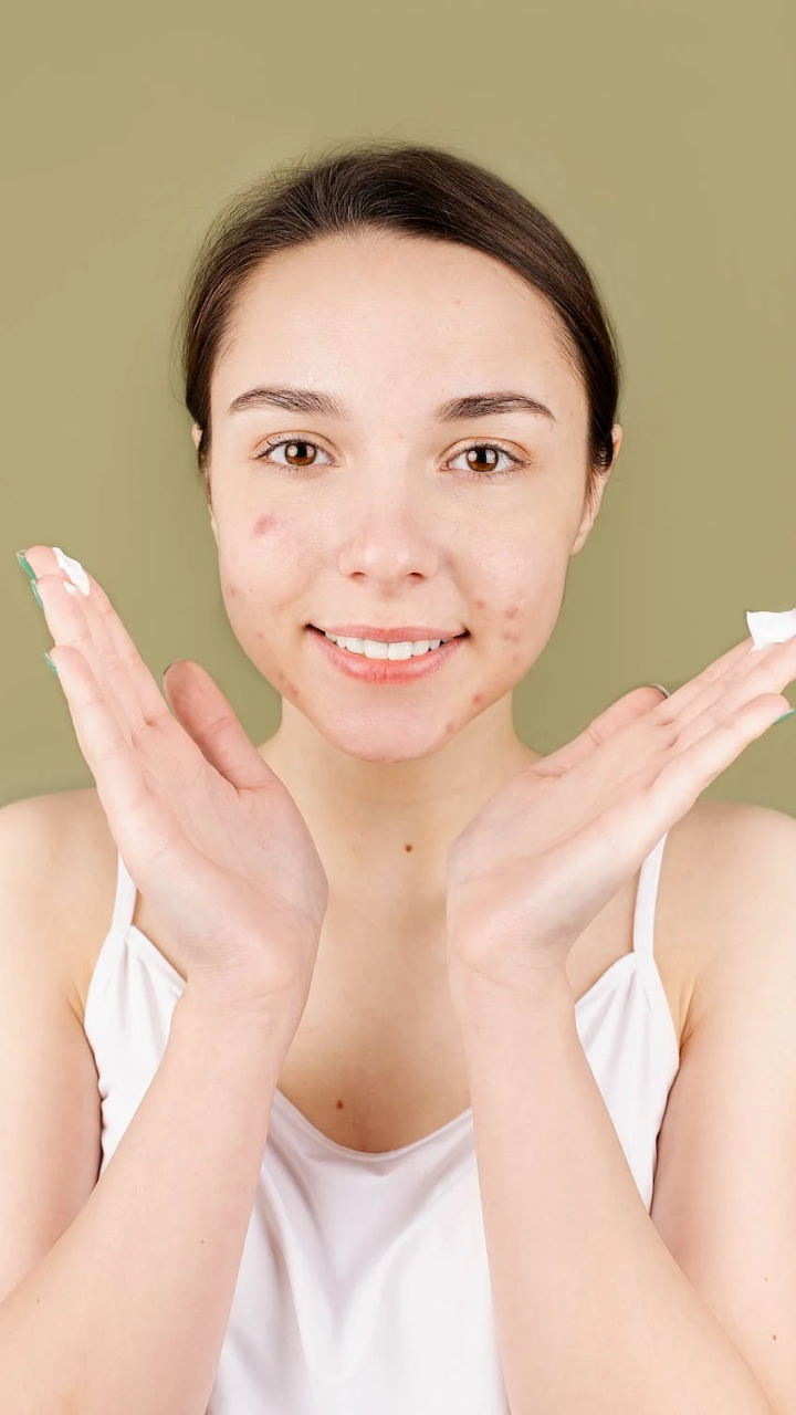 Korean Beauty tips To Get Rid Of Pimples