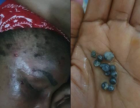See the current looks of Popular Actress who was shot 10 times in the head - Photos