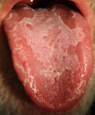 Bizarre Condition Makes Tongue Resemble a Geographic Map | Live Science