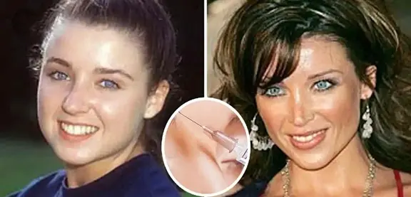 SURGERY GONE WRONG: Much Surgery Turned This Lady Look (See Photos)