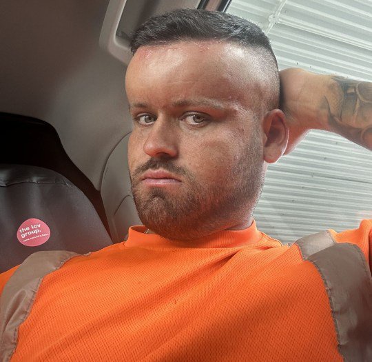 PIC FROM Kennedy News and Media (PICTURED: Ryan Briggs, 27, at work the day after using hair dye as his face began to swell due to an allergic reaction) A bloke says a horror hair dye reaction gave him a giant 'BALLOON HEAD' like the cartoon character Megamind - leaving his own girlfriend 'unable to even look at him'.Shocking photos show how Ryan Briggs's entire head swelled up, at first in a large tyre-like shape around his forehead, before his entire face followed suit - needing to take 25 tablets a day to reduce it.Ryan Briggs went over to his mum's house earlier last month [27th July] and found she'd bought him some brown hair dye to help to cover up a couple of new grey hairs.DISCLAIMER: While Kennedy News and Media uses its best endeavours to establish the copyright and authenticity of all pictures supplied, it accepts no liability for any damage, loss or legal action caused by the use of images supplied and the publication of images is solely at your discretion. SEE KENNEDY NEWS COPY - 0161 697 4266