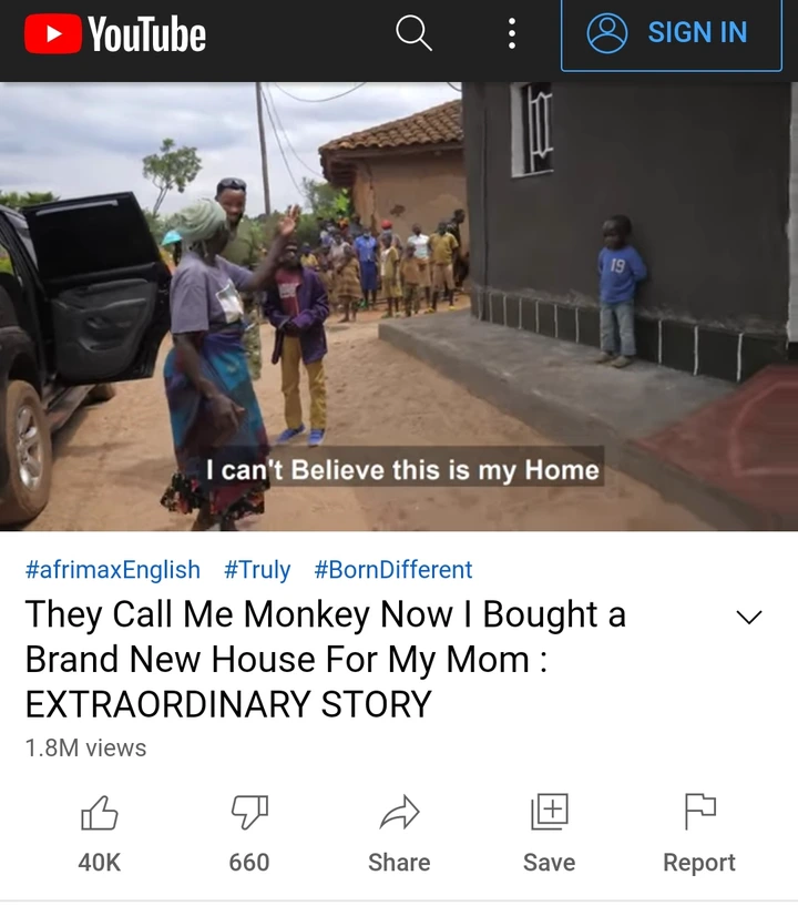 Remember The Boy Who People Referred To As A 'Monkey', See the beautiful house he has bought for his mother - Photos
