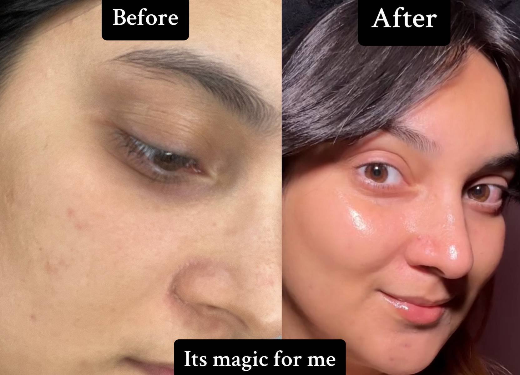 The stunner shared snaps of herself before and after using the DIY mask