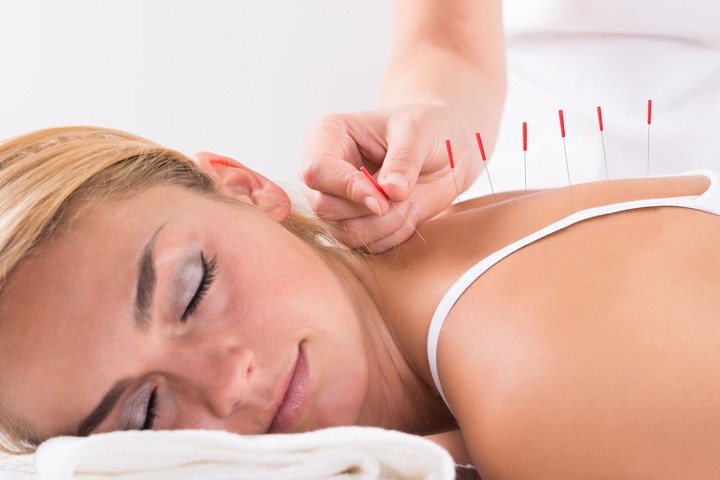 Application of Acupuncture to Treat Low Back Pain
