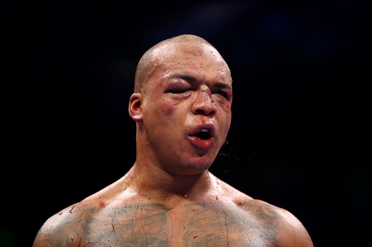 Fabio Wardley absorbed immense damage before the fight was stopped in round 11