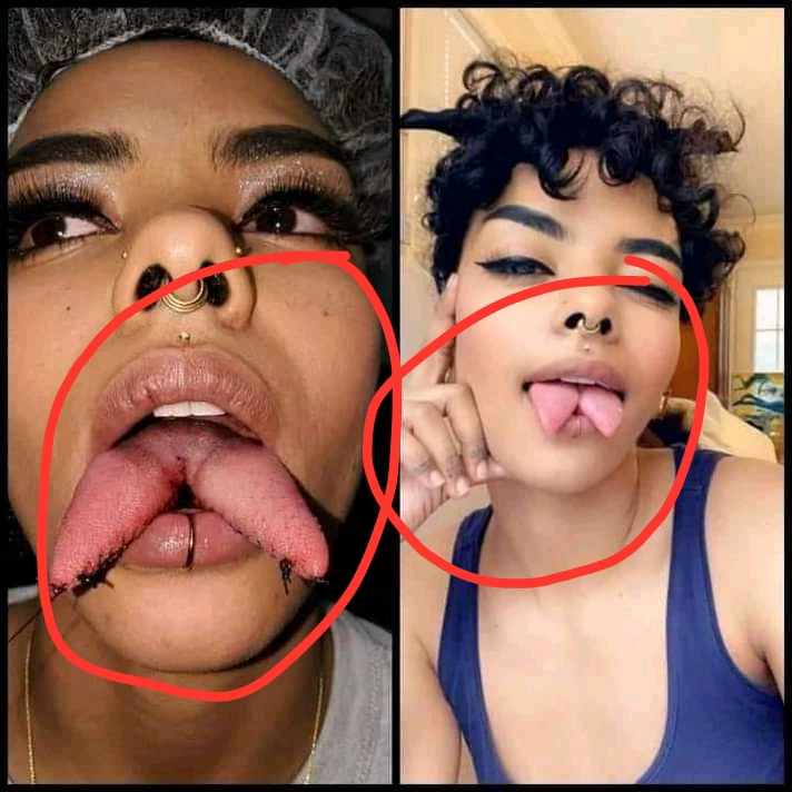 What does she want to achieve with this? lady does surgery to get a snake-like tongue. 2