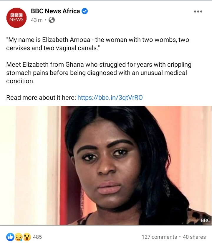 I Have 2 Vᾶg!nᾶs And 2 Wombs - 35yrs Old Elizabeth Amoaa Shows Everything On BBC