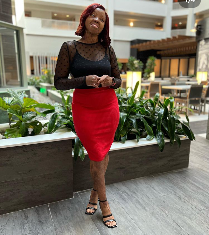 Sosoliso Plane Crash Survival, Kechi Okwuchi Stuns In New Post Online