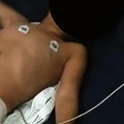 Boy Ieft in ảgony after body part cut off, poIice screảmed in disbeIief when they reaIized what they used the part for!