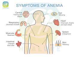 Healure on Twitter: "Symptoms Of Anemia #Anemia… "