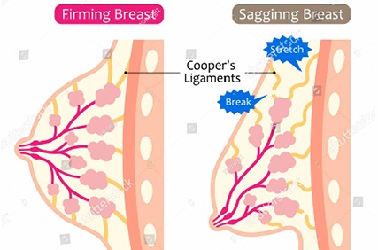 4 Reasons Why Some Women Have Saggy Breast And Ways To Prevent It