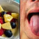 People horrified after finding out why their mouths tingle after eating pineapple