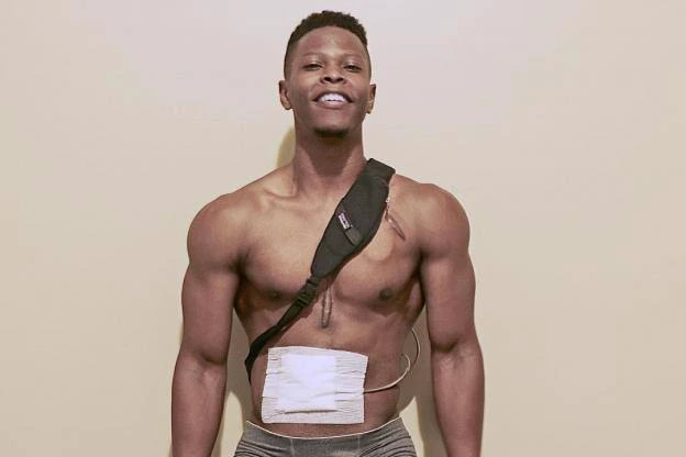 Meet Andrew Jones, a fitness model who carries his heart in a bag pack (Photos)