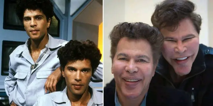 These Twin Brothers Changed Their Faces With Plastic Surgery, They Looked Before (See Photos)