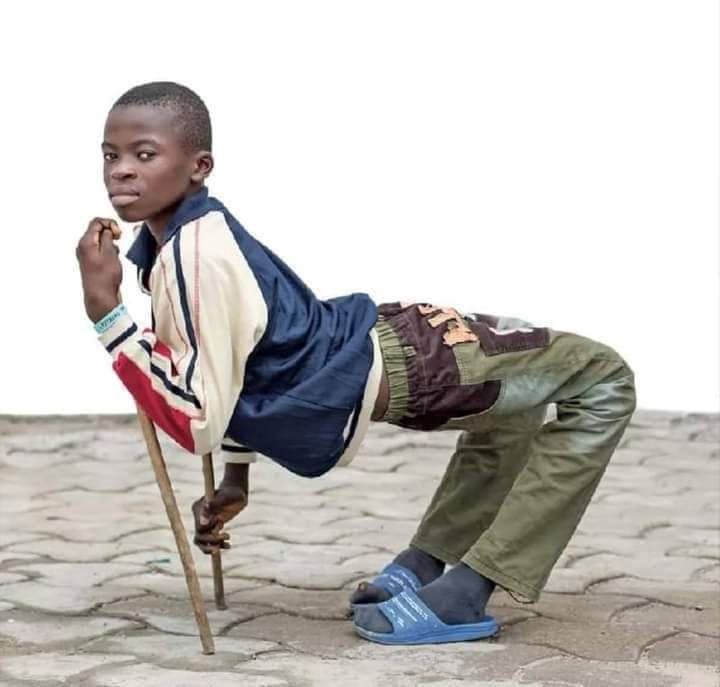 Togo : L'Histoire Miraculeuse D'Abel, Le Garçon Handicapé Qui Marche De Nouveau Droit