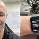 Man says Apple watch 'saved his life' after bike crash that left him 'looking like monster'