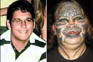 dennis avner before and after pictures