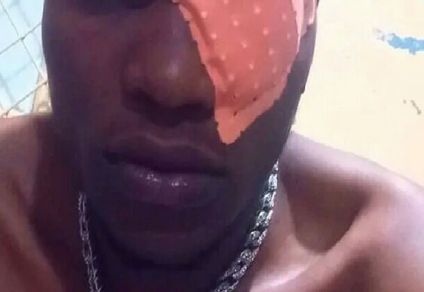 28-year-old man loses his left eye over a car fight - Photos