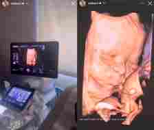 Vanderpump Rules Lala Kent 3-D Ultrasound of Baby Number Two