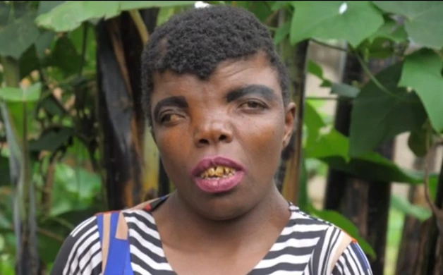 Video: « Je Mourrai Célibataire, Les Hommes M'Appellent La Femme La Plus Laide Du Monde »